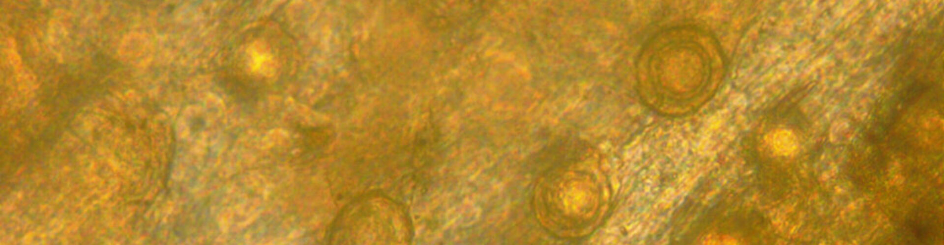 aphanomyces-featured-v2