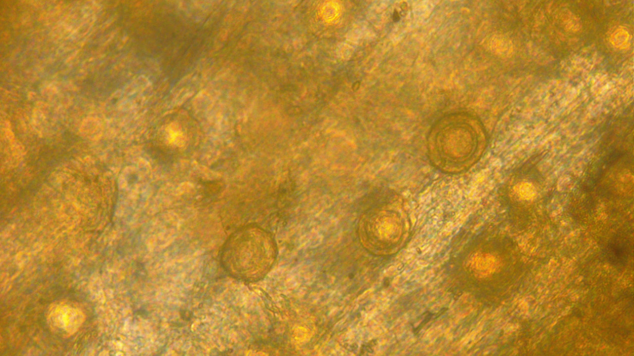 aphanomyces-featured-v2 aphanomyces-featured-v2