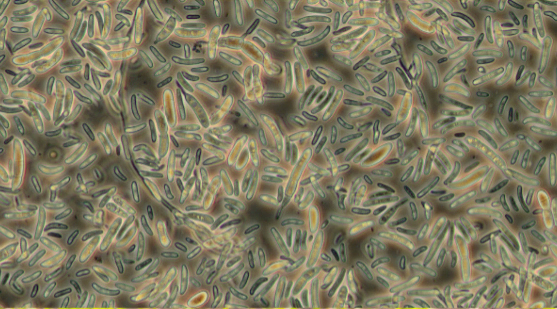 seed-borne-diseases